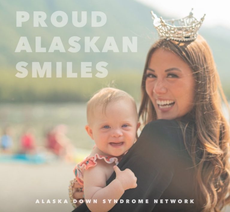 Welcome home planned for Miss America Emma Broyles at Anchorage airport at 2:30 pm Sunday