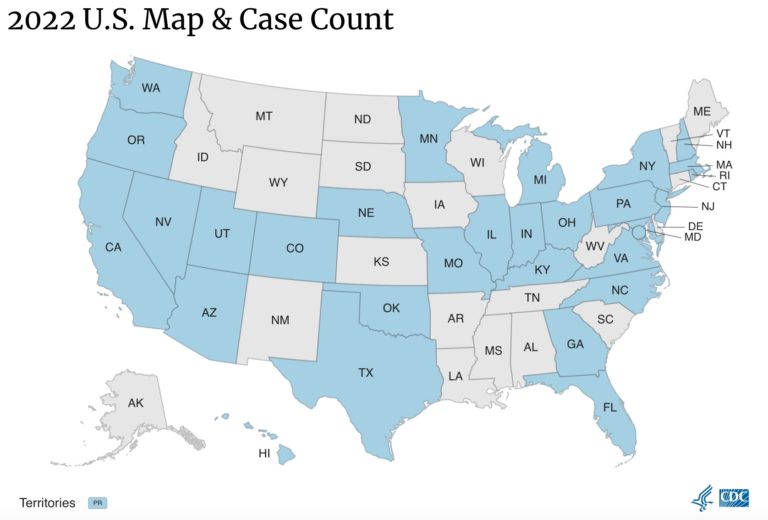 Monkeypox now in 30 states, plus Puerto Rico, and nearly doubled cases in one week to 396