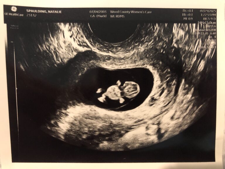 State of Alaska Appeals to the Supreme Court, Challenging 2024 Planned Parenthood-backed Ruling 